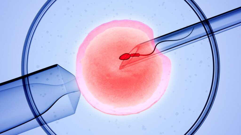 Ivf center in delhi 