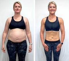 a women image who compare his Weight loss journey before and after with nitrilean